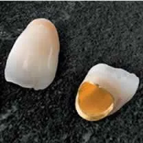 メタルボンド(PGA)