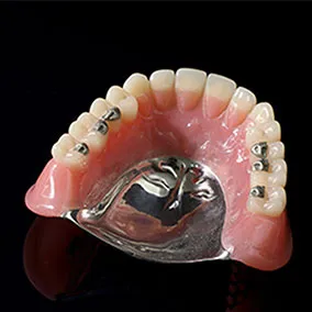 自費診療の入れ歯