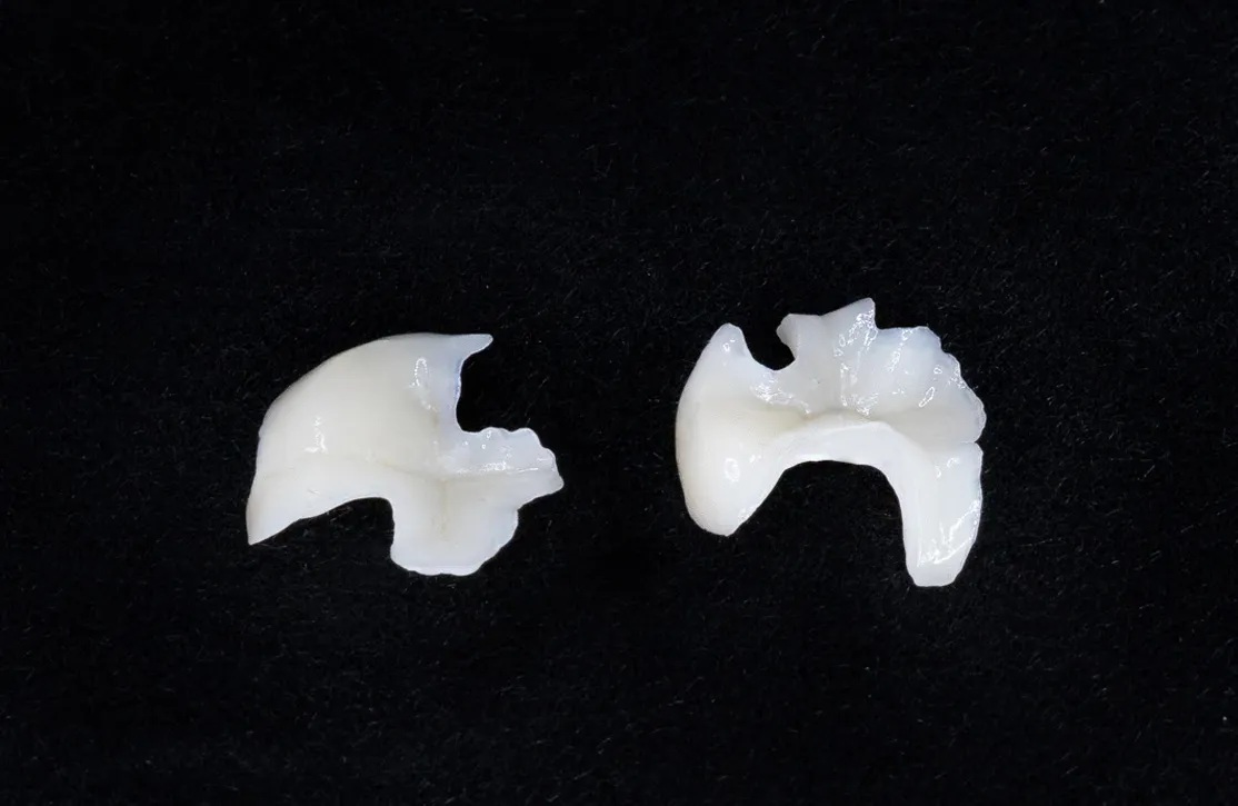 セレックインレー