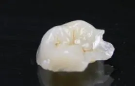 オールセラミック
セレックインレー