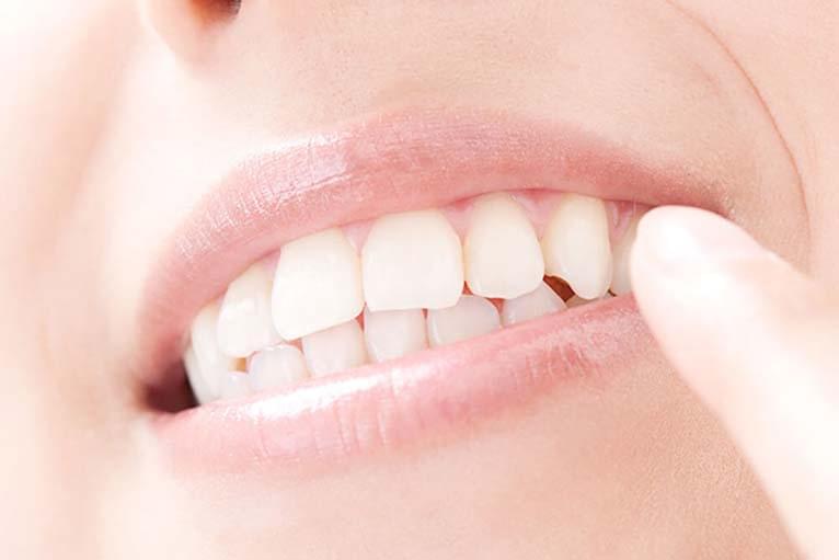 【セレック】即日のセラミック治療を実現