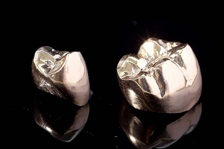 ゴールドメタル