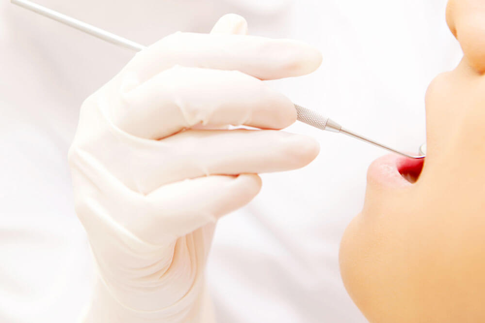 口腔内のチェック